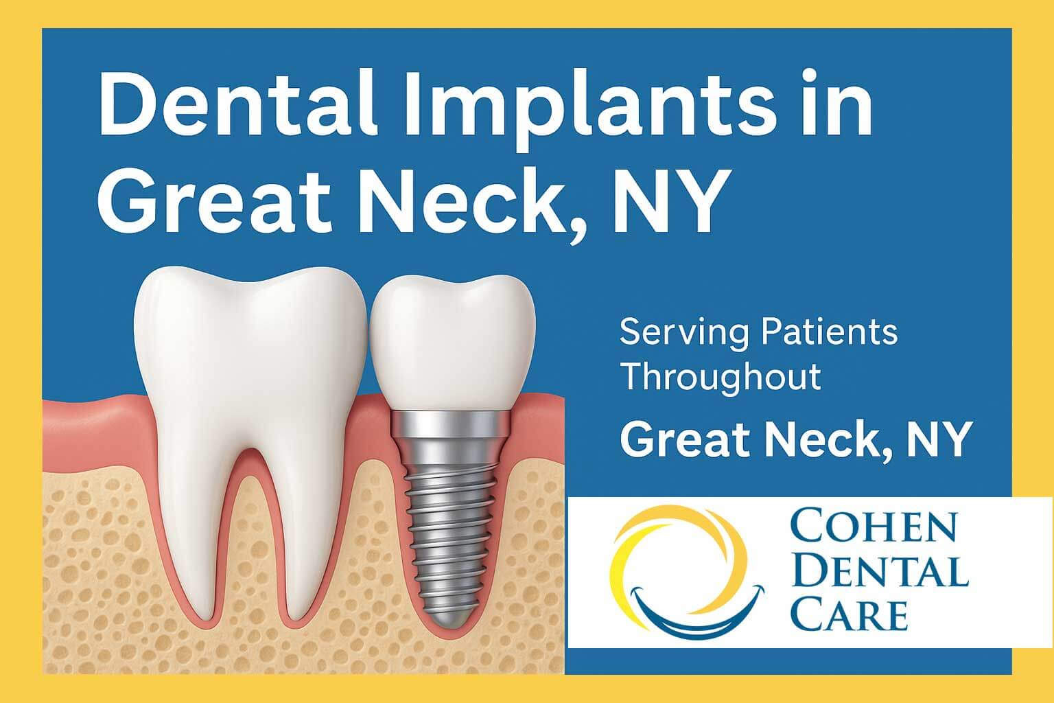 Dental Implants Great Neck NY